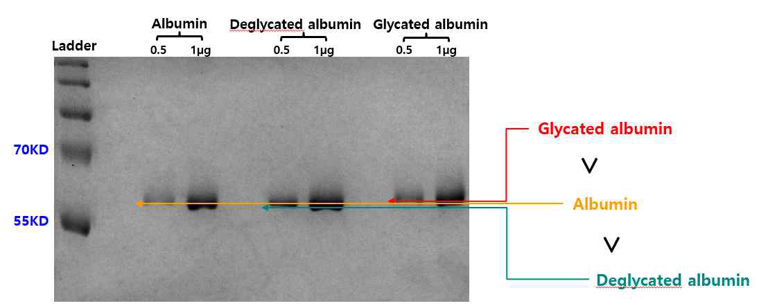 폴리아크릴아마이드겔 전기영동법(SDS-PAGE)을 통한 알부민, 비당화알부민, 당화알부민 항원의 정량분석 결과