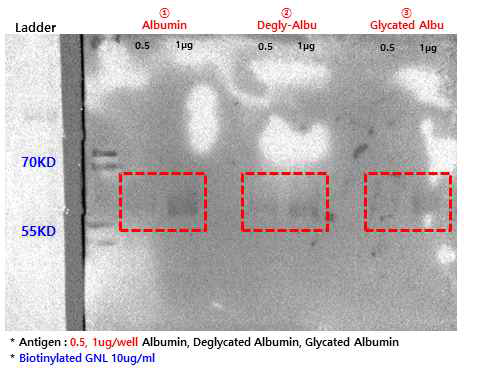 웨스턴블롯(Western blot)을 통한 알부민, 비당화알부민, 당화알부민 항원의 렉틴(GNL)과의 반응 테스트