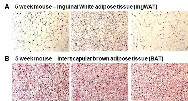 POMCΔCRIF1 mice 의 inquinal adipose tissue와 BAT에서의 browning