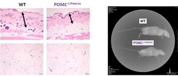 POMCCA-PKA mice의 피부 및 척추 표현형