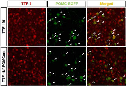 TTF-1 f/f;POMC cre mice 검증