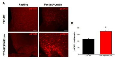 TTF-1 f/f;POMC cre mice에서 렙틴의 반응성 분석