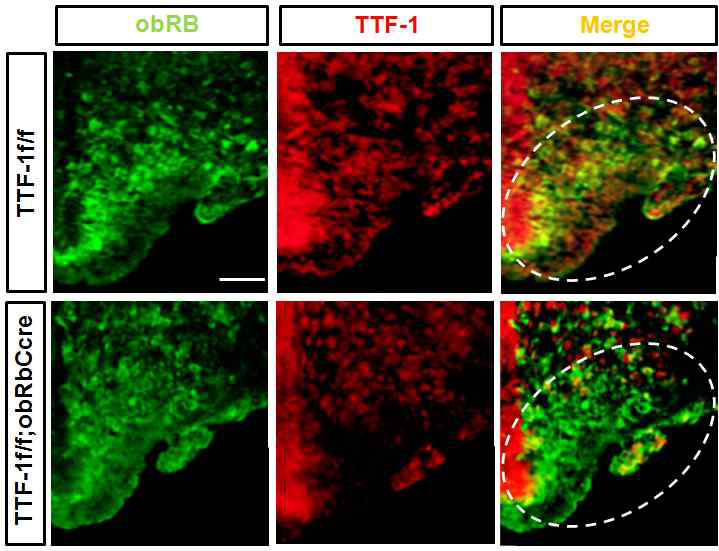 TTF-1 f/f;obRb cre mice 검증