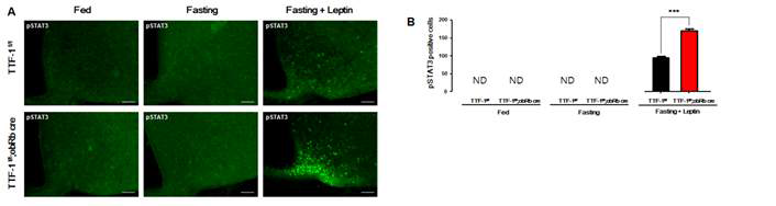 TTF-1 f/f;ObRb cre mice에서 렙틴에 의한 p-STAT3 발현 분석