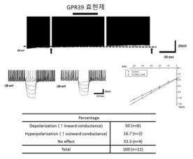 시상하부 활꼴핵 POMC 뉴런 GPR39의 기능적 발현