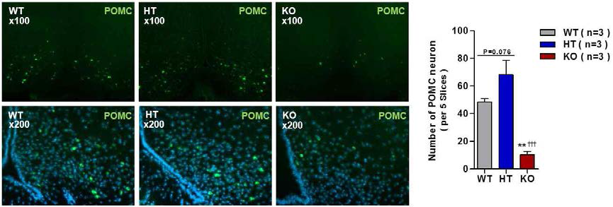 POMCΔCRIF1 mice에서의 POMC 뉴런 수의 감소