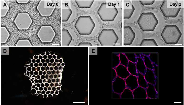 HUVEC 세포를 이용한 콜라겐 기반의 혈관세포형 바이오페이퍼. (A) 로딩 직후, (B) 1일 후, (C) 2일 후 몰드 위에서의 콜라겐 기반 바이오페이퍼 모습. (D) 4일 간의 배양 후 몰드에서 분리한 콜라겐 기반 바이오페이퍼의 모습. (E) 액틴 염색(빨강)으로 확인한 바이오페이퍼 내에서 형성된 혈관 구조. 대조 염색으로 세포핵 염색 이용(파랑). Scale bar = (A-C) 100 μm, (D) 1 mm, (E) 200 μm