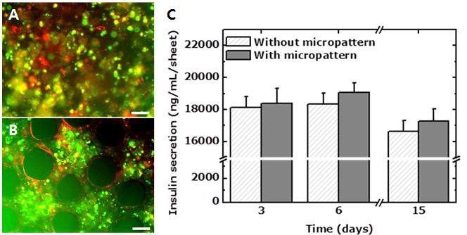 패턴 유무에 따른 바이오페이퍼 내 다종세포형 베타세포 클러스터의 형성 및 인슐린 분비 기능의 차이 관찰. (A) 패턴이 없는 콜라겐 바이오페이퍼 내에서 MIN6 세포와 MS-1 세포를 공배양한 모습. (B) 클러스터 패턴과 이를 이어주는 연결 패턴을 가진 콜라겐 바이오페이퍼 내에서 MIN6 세포와 MS-1 세포를 공배양한 모습. Scale bar = 50 μm