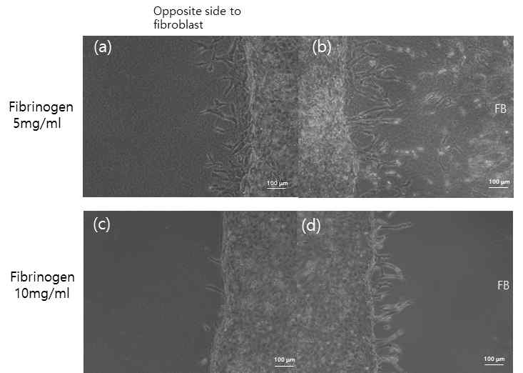 fibrinogen 지지체 농도에 따른 신생혈관 형성 변화. 농도가 낮을 때 섬유아세포가 없는 방향으로도 혈관이 형성되지만, 높을 때에는 섬유아세포 방향으로만 혈관형성이 유도됨