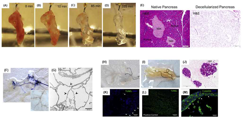 Decellularized 췌장 조직 모사 지지체 , (A)~(D) 시간에 따른 decelluarized 지지체의 모습, (E) H&E staining을 통한 세포 유기질 성분 분석, decelluarized 지지체의 경우 보라색이 거의 보이지 않음, (F)~(G) decelluarized 지지체 내부의 vessel 구조 모습, (H)~(J) 실제 췌장세포 배양 후의 췌도 조직 형성 test, (K)~(M) immunostaining을 통한 베타세포 특이 반응 분석 (Pittsburgh 대학의 Ipsita Banerjee 교수 연구팀)