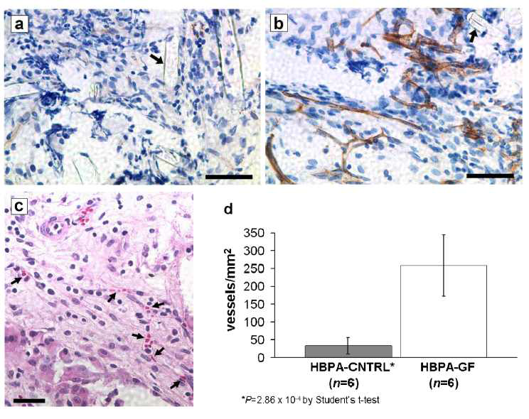 Heparin-PLA에 VEGF, FGF 처리에 따른 혈관 형성 , CD31 staining (A) control and (B) growth factor binding fibers (C) neo-vessel structure를 보여주기 위한 H&E staining (시카고 northwestern 대학의 Samuel I. Stupp 교수 연구팀)