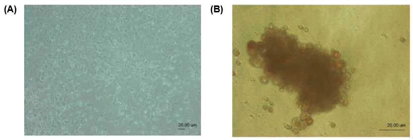 Pancreatic epithelial cell을 이용한 베다세포 분화 cluster, (중국 Zhejiang 연구소의 Xiaoju Wang 교수 연구팀)