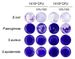 미생물 초기 농도 및 FBS 유무에 따른 바이오필름 형성(Crystal violet staining)