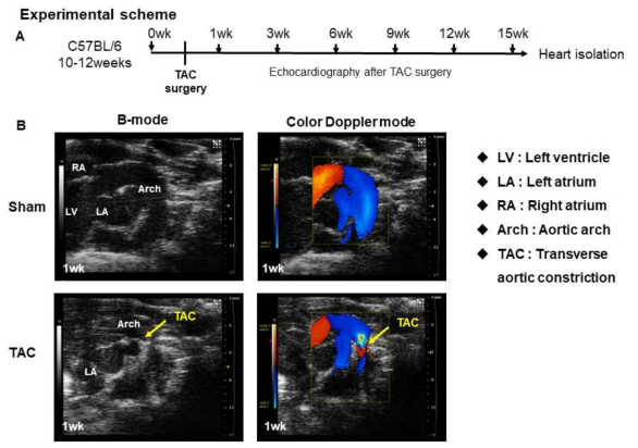 TAC (A) 수술 계획, (B) 심장 초음파