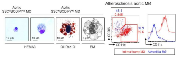 BODIPY 유세포분석법으로 추출한 포말 및 비포말 대식세포의 확인