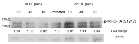 oxidized LDL에 의한 대식세포 non-muscle myosin IIA heavy chain의 인산화