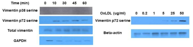 oxLDL에 의한 정상 대식세포에서의 vimentin 인산화