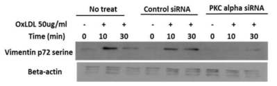 PKC-alpha siRNA를 사용하여 PKC-alpha 발현을 막으면 oxLDL에 의한 vimentin 인산화가 억제됨