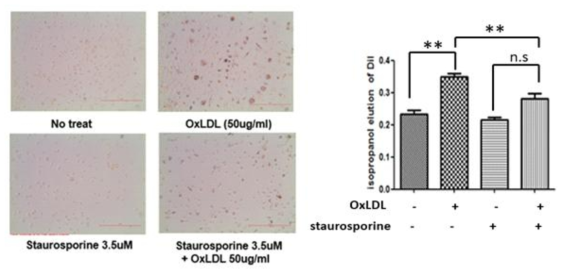 PKC-alpha 억제시 대식세포의 oxLDL uptake가 저하됨(oil-red O staining)