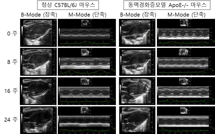 정상 및 동맥경화증 모델 마우스의 좌심실기능분석을 위한 심장 초음파 영상