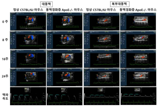 정상 및 동맥경화증 모델 마우스의 대동맥 및 복부대동맥 기능분석을 위한 심장 초음파 영상