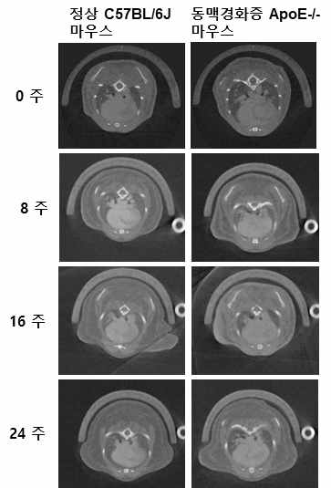 전임상 정상 및 동맥경화증 모델 마우스의 micro- CT 영상 데이터 정보의 확보