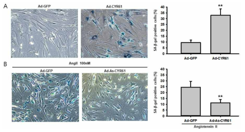 CYR61 induces cellular senescence in hCSMCs. (A) CYR61을 증가 시켰을 때 hCSMC의 노화가 유의미하게 증가하였음, (B) AngII로 노화를 유도 하였을 때 CYR61을 억제하면 AngII에 의한 노화효과가 감소되었음