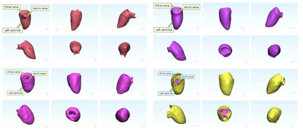 해부학적 구조를 기반으로 제작한 3D 좌심실 벽과 혈류영역 모델