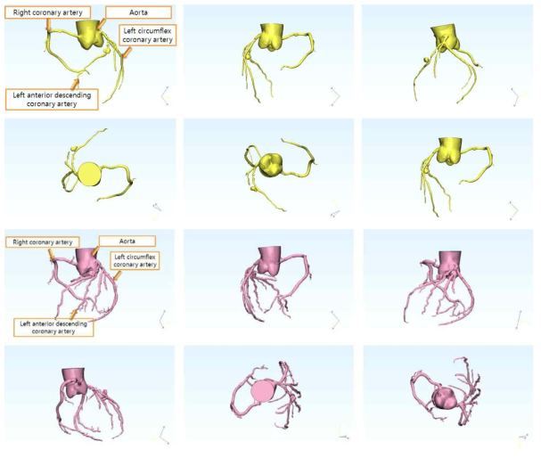해부학적 구조를 고려하여 제작한 3D 사람 혈류영역 관상동맥 모델
