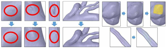 ANSYS SpaceClaim을 이용한 형상정리 및 표면 재생성. 혈관 표면에 날카로운 부분 및 중첩 형상을 수정함. 혈관 외벽을 스무딩 작업을 통해 부드럽게 수정함. 격자 생성을 위해 혈관 외벽을 따라 표면 재생성함