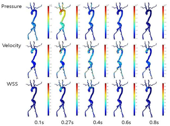 이미지 기반 대동맥, 경동맥 및 대퇴동맥을 포함한 전체 혈관모델에서 심장주기에 따른 압력, 속도 및 벽 전단응력의 변화 분석