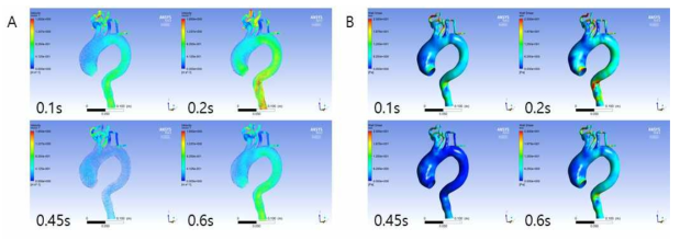 상행 대동맥류 환자모델에서 심장주기에 따른 속도 및 벽 전단응력 분포 분석. (A) 심장주기에 따른 속도 분포, (B) 심장주기에 따른 벽 전단응력 분포
