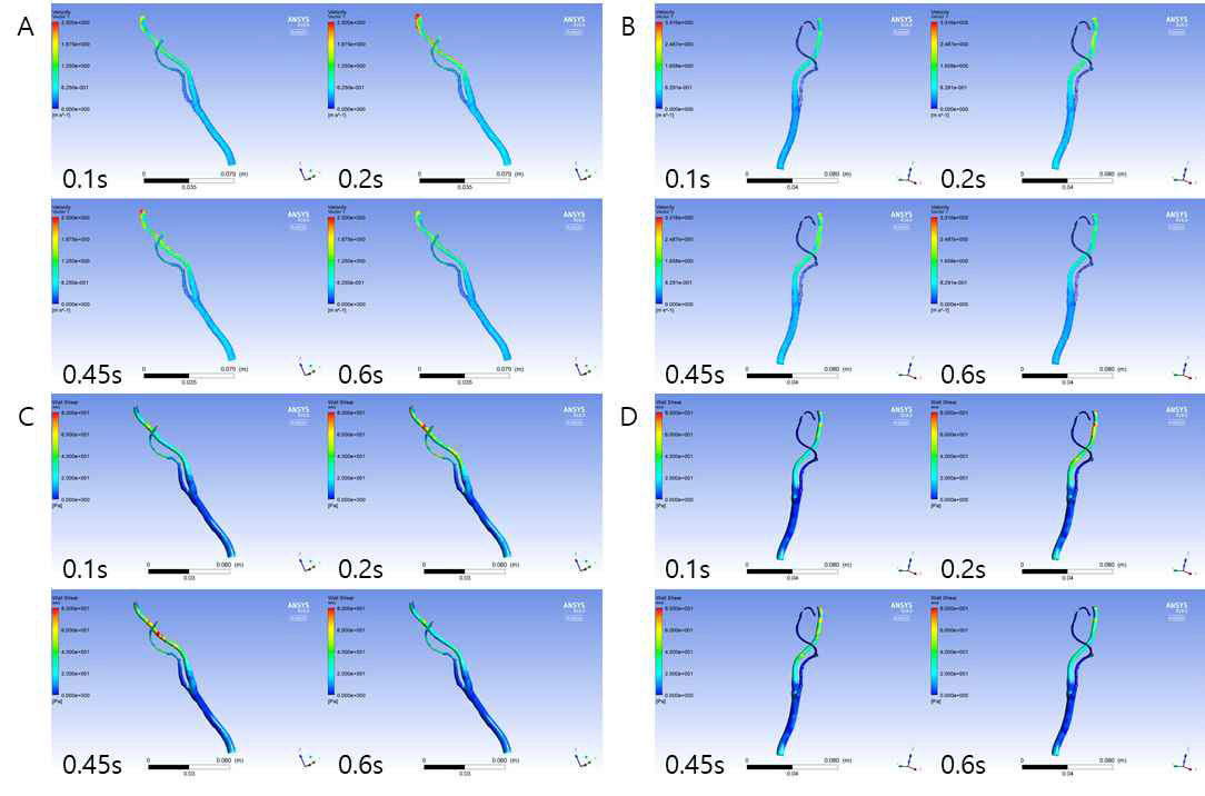 89C 환자의 좌,우경동맥에서의 심장주기에 따른 속도 및 벽 전단응력 분포 분석. (A) 좌경동맥 속도, (B) 우경동맥 속도, (C) 좌경동맥 벽 전단응력, (D) 우경동맥 벽 전단응력