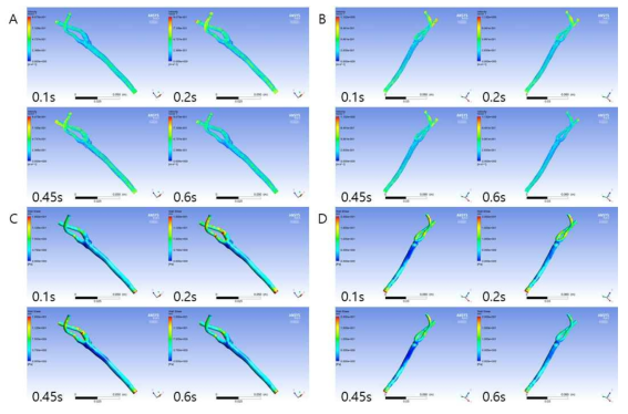 097 Y 환자의 좌,우경동맥에서의 심장주기에 따른 속도 및 벽 전단응력 분포 분석. (A) 좌경동맥 속도, (B) 우경동맥 속도, (C) 좌경동맥 벽 전단응력, (D) 우경동맥 벽 전단응력