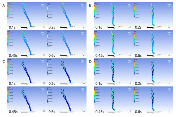 094 K 환자의 좌,우경동맥에서의 심장주기에 따른 속도 및 벽 전단응력 분포 분석. (A) 좌경동맥 속도, (B) 우경동맥 속도, (C) 좌경동맥 벽 전단응력, (D) 우경동맥 벽 전단응력