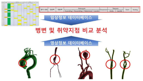 임상정보와 영상정보 데이터베이스를 이용한 병변 및 취약지점 비교 분석