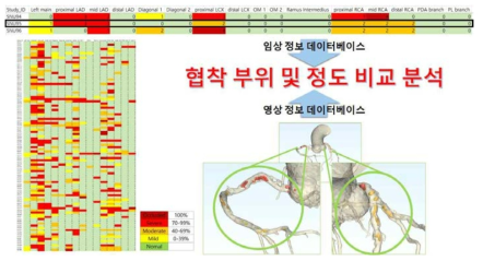 임상정보와 영상정보 데이터베이스를 이용한 협착 부위 및 정도 비교 분석