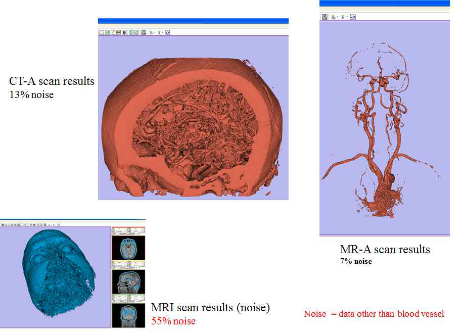 MRI 영상 3D 데이터 변환 알고리즘