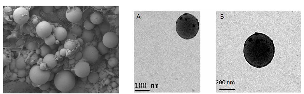 안토시아닌이 결합된 PLGA nanoparticle 의 SEM 및 TEM 전자 현미경 사진