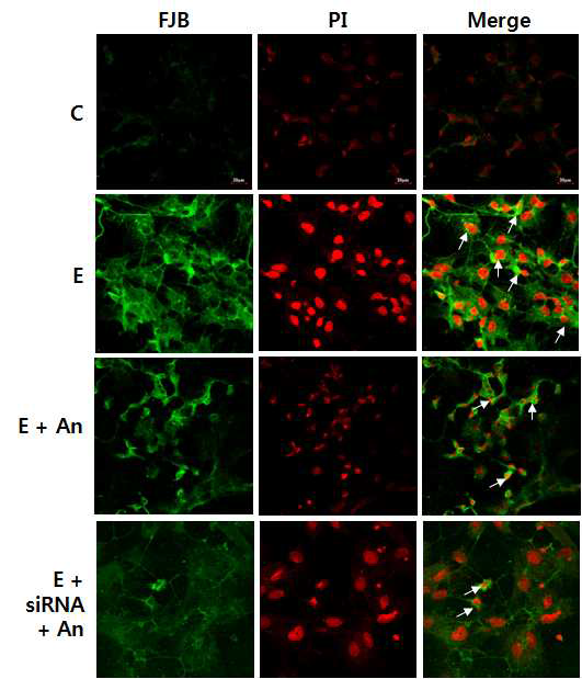 태아 17.5일의 해마부위를 초대배양하여 안토시아닌을 처리 하였을 때, 에탄올에 의해 유도된 신경퇴행을 억제시킴을 FJB(green)와 PI(red) 염색을 통해 confocal로 확인. Control (C); 100 mM ethanol (E); 100 mM ethanol + 0.1 mg/mL anthocyanins (E+An) and 100 mM ethanol + 0.1 mg/ml anthocyanins added to cells transfected with 40 nM GABAB1RsiRNA(E+siRNA+An). 40× objective field, scale bar=20 μm