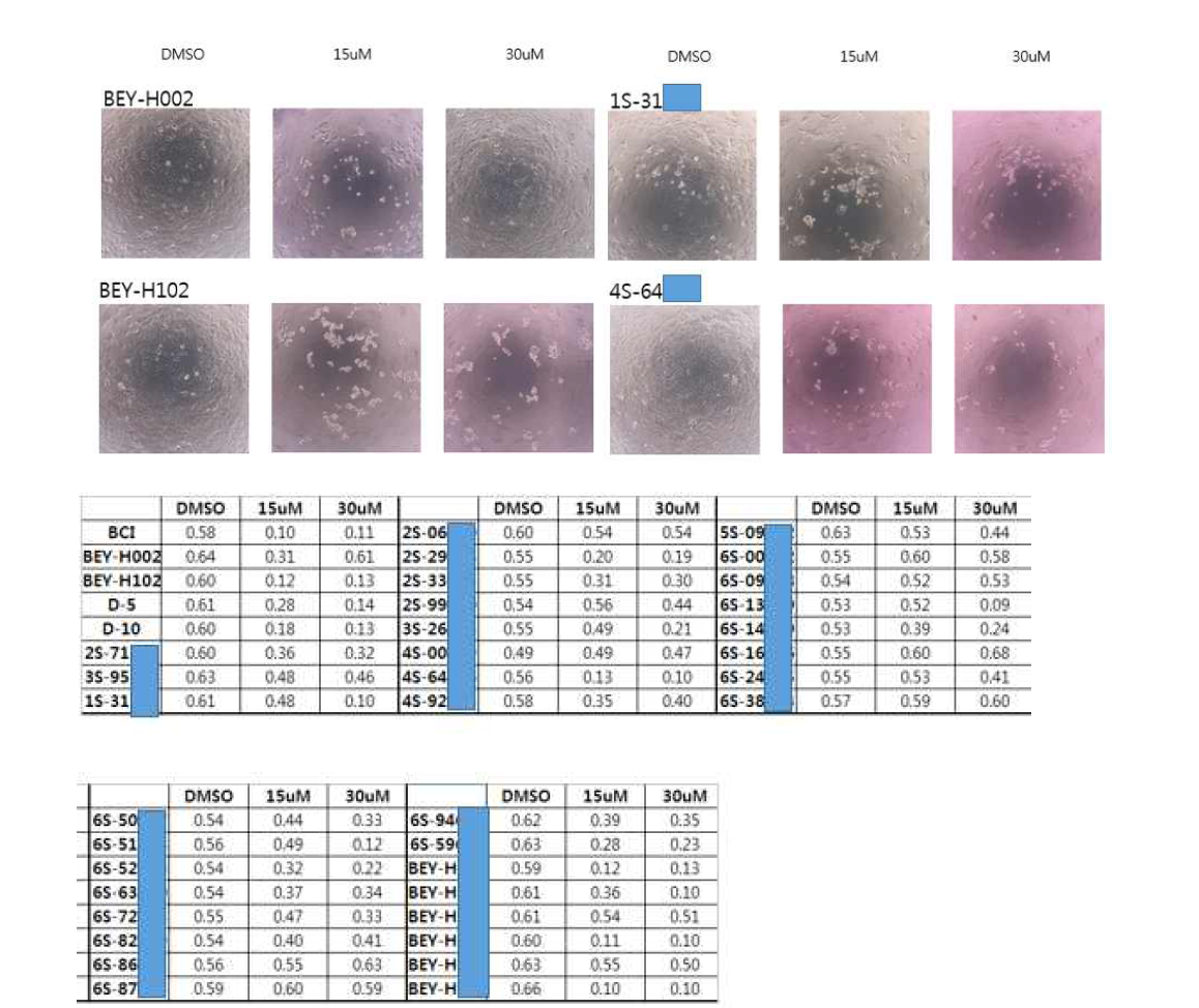 간암 세포주 (Hep3B) 의 성장저해 효과 예 (위: 세포주 사진, 아래: MTT assay)