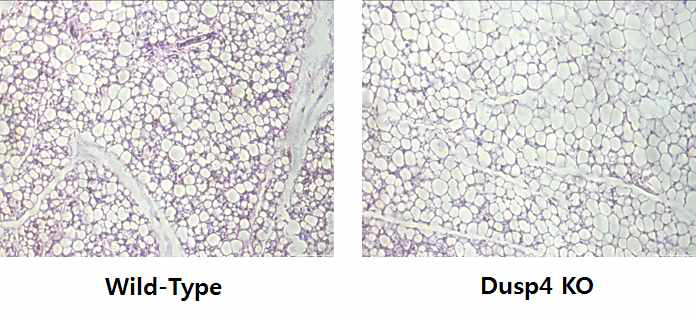 DUSP4 KO 마우스 모델에서의 ingWAT의 형태적 변화