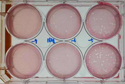 바이러스 접종물 Plaque assay 결과