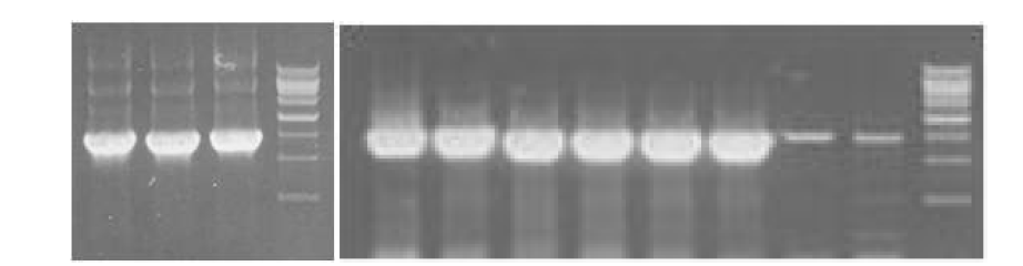 HPV L1 PCR(좌), cloning 된 transfer vector colony PCR(우)