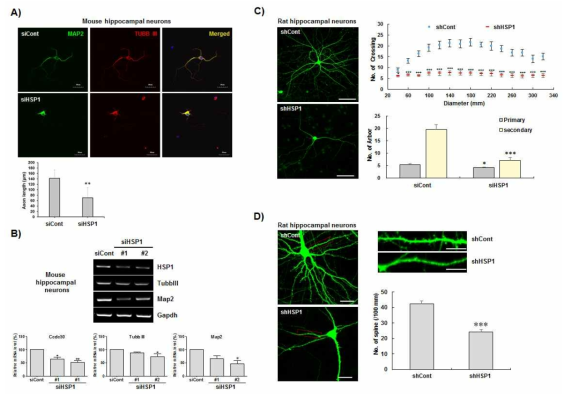 HSP1의 Knockdown시 Hippocampal neuron의 Axon의 길이 변화 확인