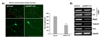 HSP1-VX의 저해에 따른 mouse Hippocampal neuron의 변화 확인