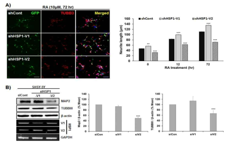 Human SHSY-5Y cell line의 HSP1의 저해에 의한 분화 능력 변화