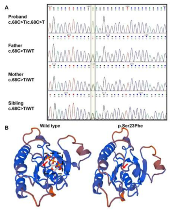 A) Sanger sequencing상 proband의 homozygous c.68C>T 변이가 확인됨. B) Swiss model을 이용한 단백질 3차원 구조 분석 결과, 해당 변이에 의해 GTP-binding region의 변화가 생기는 것이 추정됨