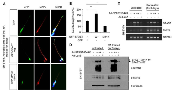 SPAST-I344K의 신경세포 분화능 조사