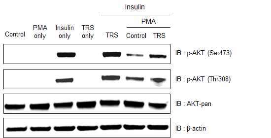 AK 유래 TRS의 지방세포 내 인슐린 신호전달 조절 변화 분석